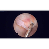 2,7 mm artroscoop